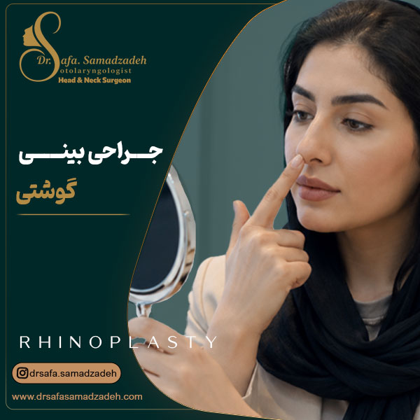 جراحی بینی گوشتی - دکتر صمدزاده