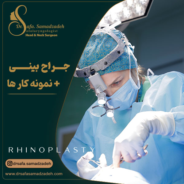 جراح بینی - دکتر صمدزاده