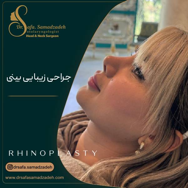 جراحی زیبایی بینی یا رینوپلاستی | دکتر صمد زاده