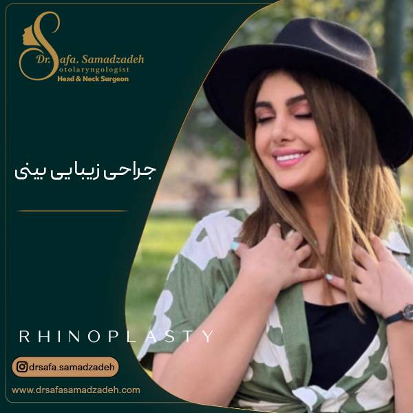 نمونه عکس راینوپلاستی یا جراحی زیبایی بینی