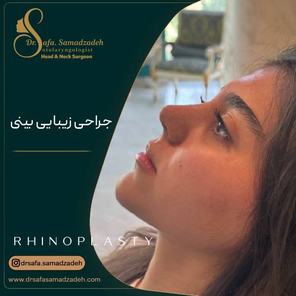 جراحی زیبایی بینی یا رینوپلاستی | دکتر صفا صمدزاده