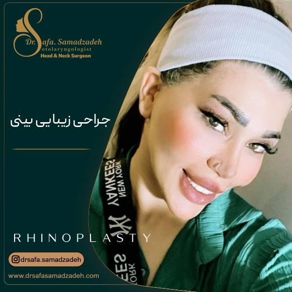 عکس نمونه عمل بینی | دکتر صفا صمدزاده