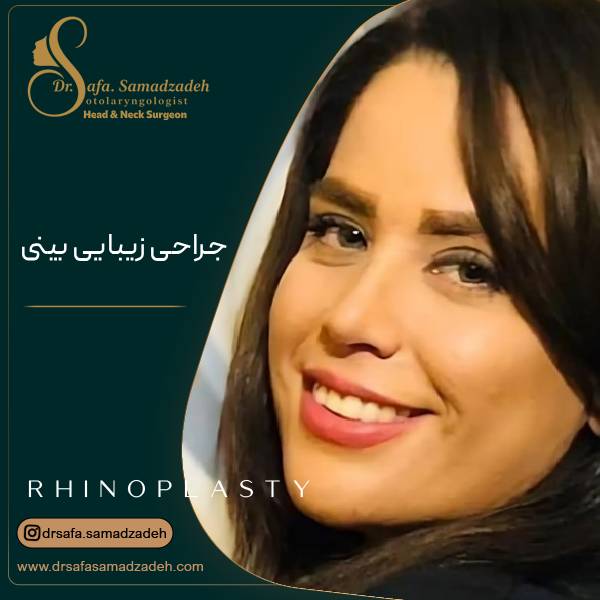 جراحی زیبایی بینی در تهران | دکتر صفا صمدزاده