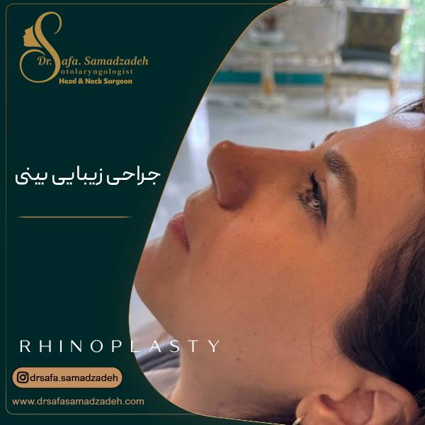 عکس جراحی زیبایی بینی یا رینوپلاستی | دکتر صفا صمدزاده