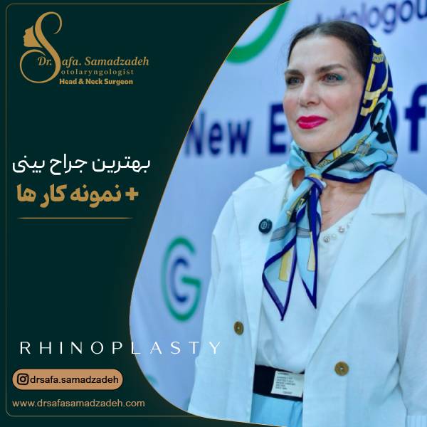 عکس بهترین جراح بینی در تهران | دکتر صفا صمدزاده