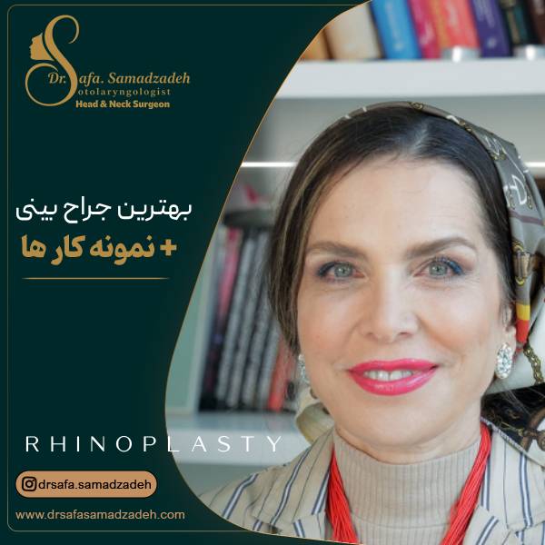 عکس بهترین دکتر عمل بینی در تهران | دکتر صمدزاده