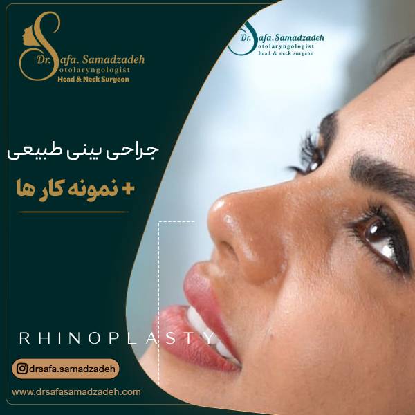 عکس عمل بینی نچرال | دکتر صمد زاده