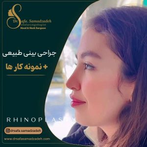 عکس جراحی بینی طبیعی و نچرال در تهران | دکتر صمدزاده