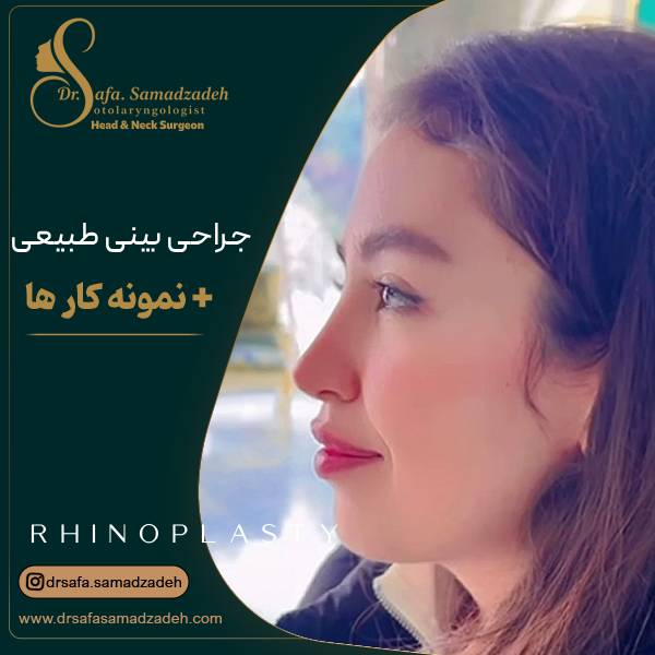 عکس جراحی بینی طبیعی و نچرال در تهران | دکتر صمدزاده